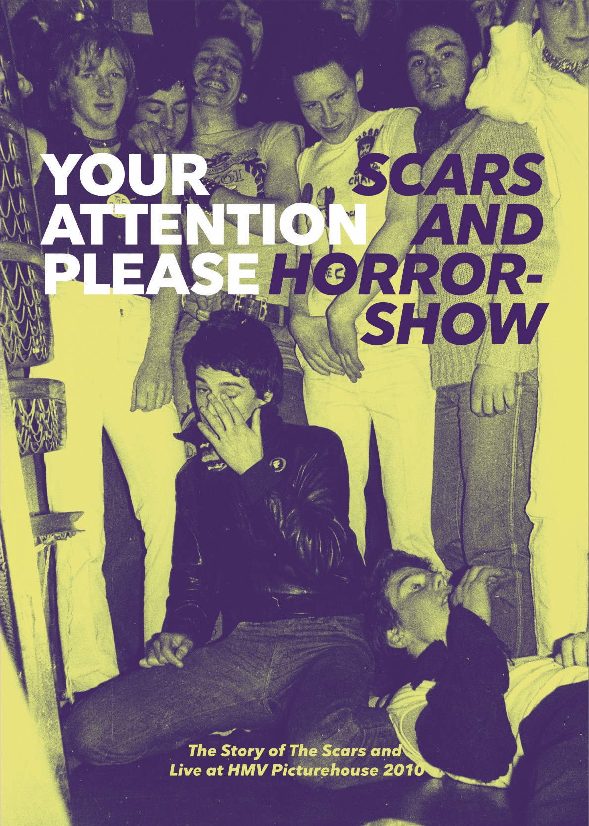 Your Attention Please: Scars