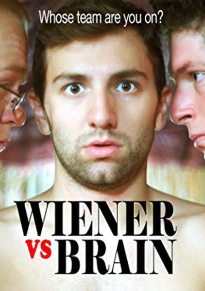 Wiener vs Brain