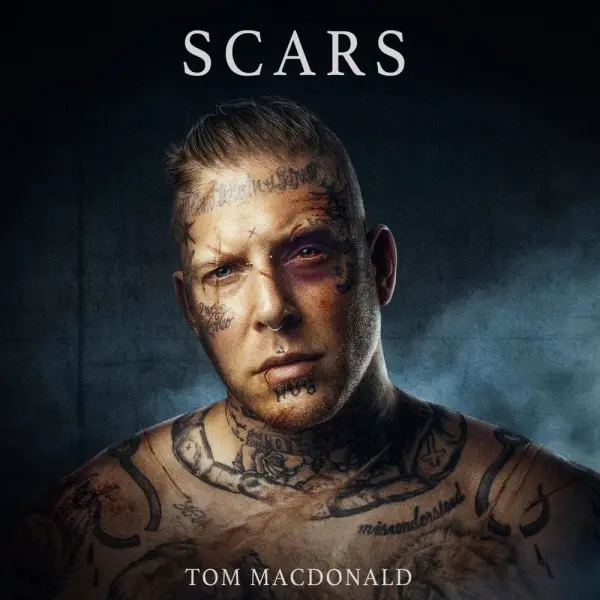 Tom MacDonald: Scars