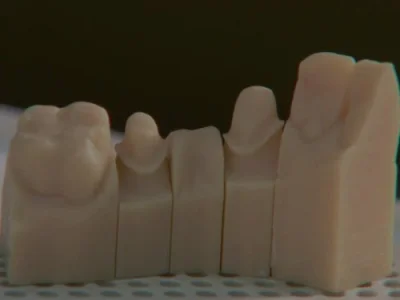 Digital Dentistry/Nail Clippers/Poster Restoration/Canola Oil