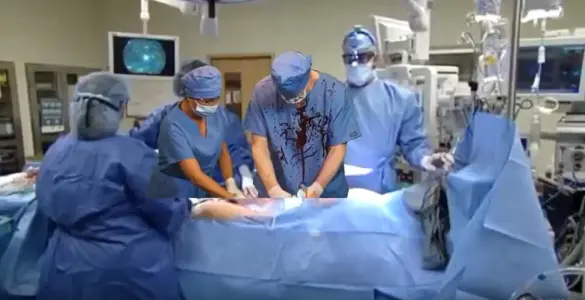 The Operation.
