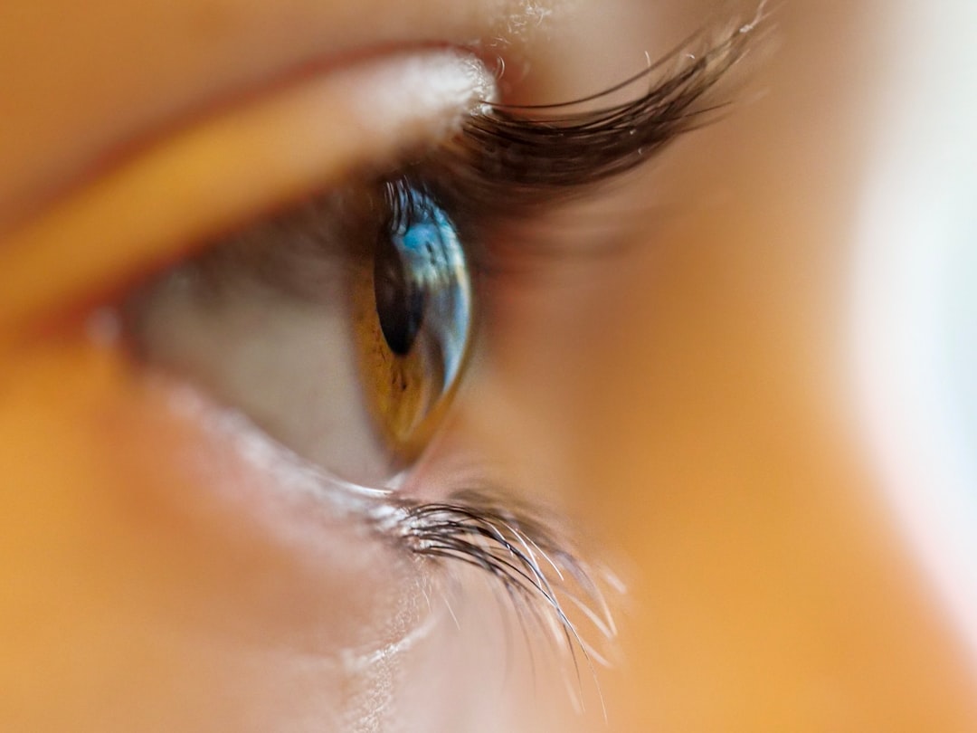Dermal Fillers for Eye Bags: The Complete Guide to Under-Eye Treatment in 2026
