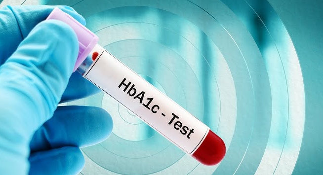 What Is a Dangerous A1C Level — And What You Can Actually Do About It